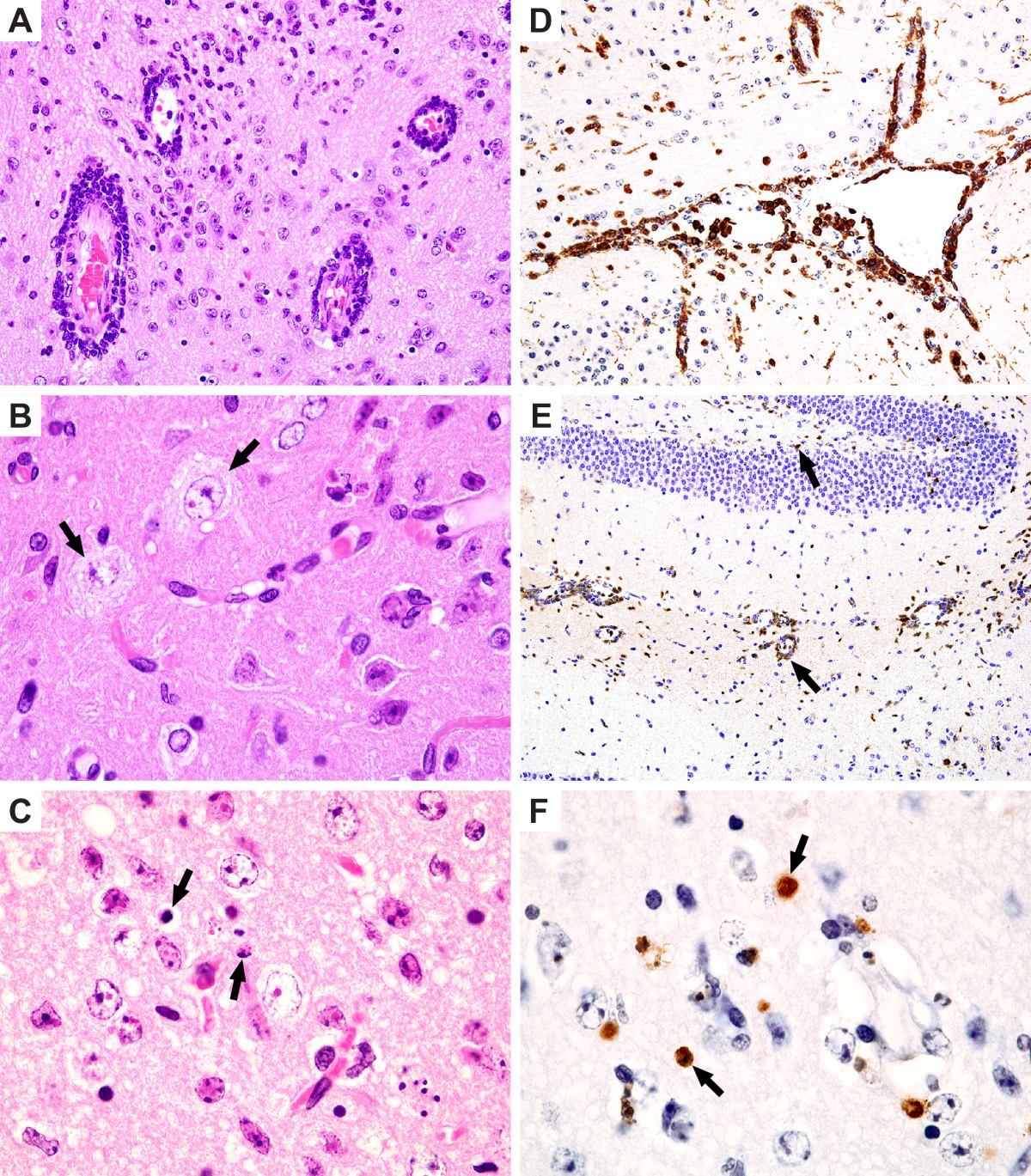 La Crosse virus infectivity, pathogenesis, and immunogenicity in mice