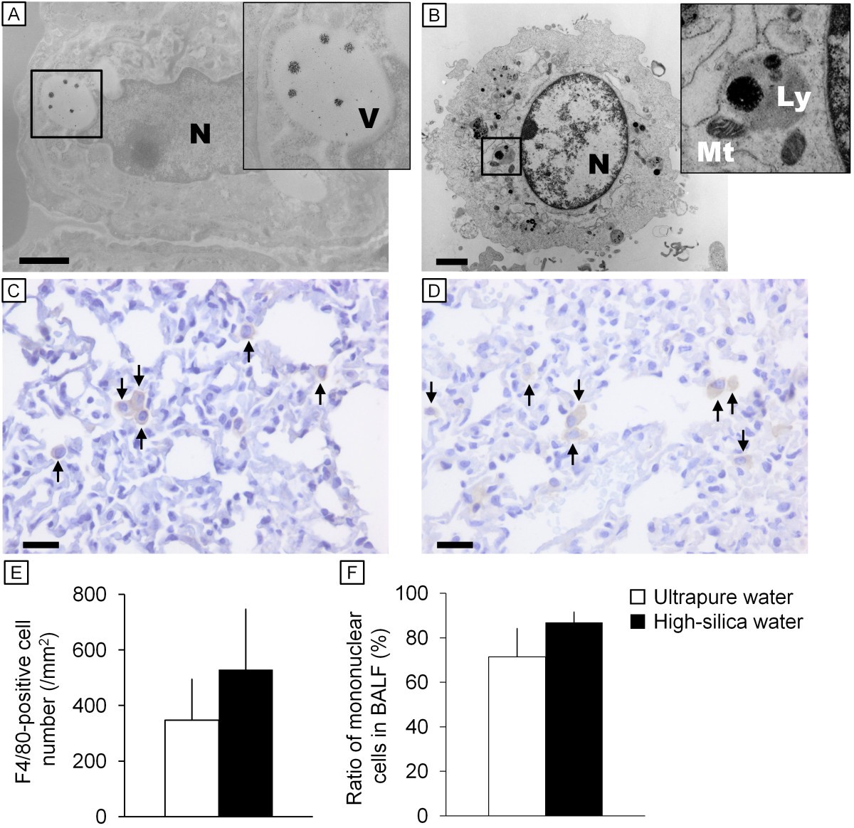 Effect of aerosol particles generated by ultrasonic humidifiers on the