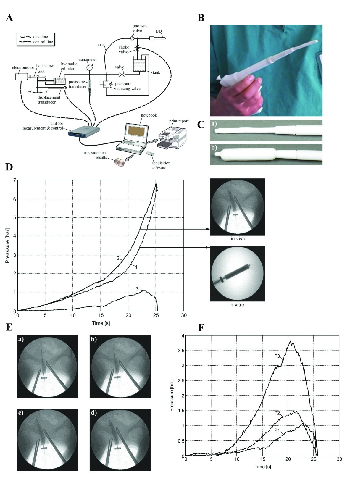Continuous controllable balloon dilation a novel approach for cervix