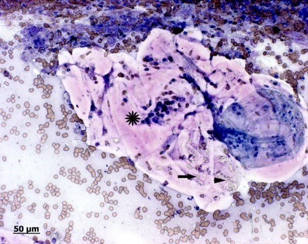 the usual loss of alveoli is minimal in a healthy individual, so the anatomic dead space is?