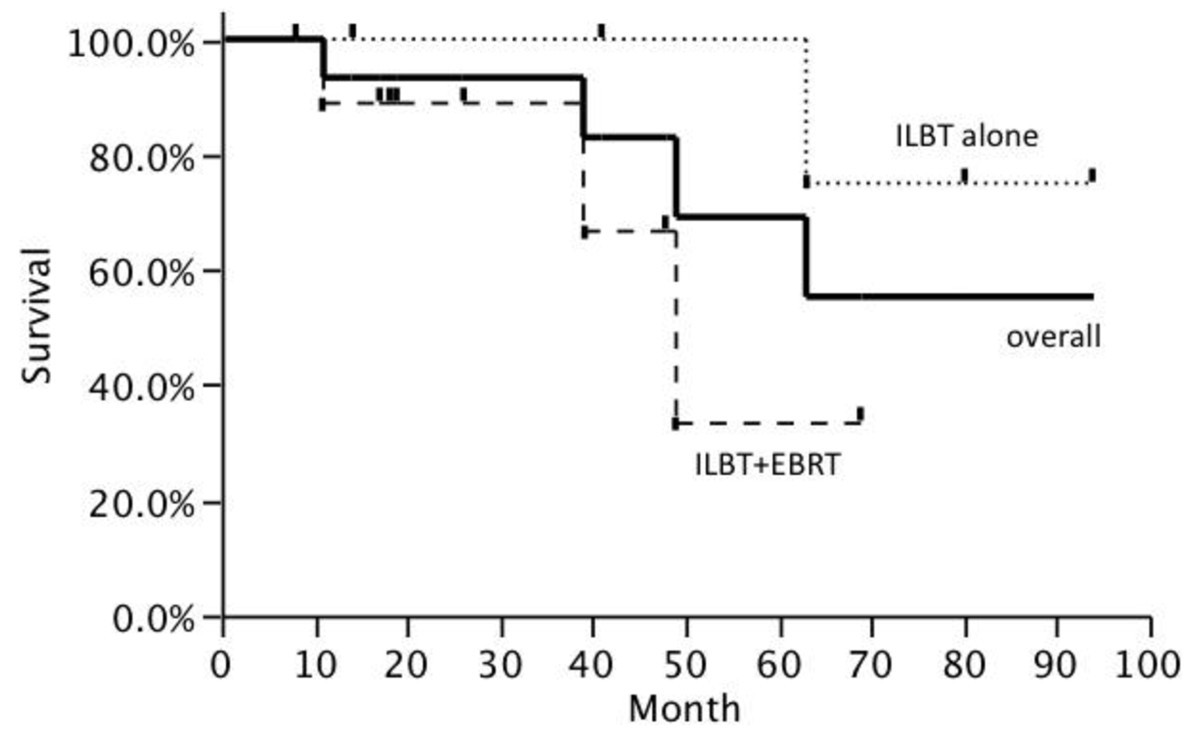 Long-term results of curative intraluminal high dose rate brachytherapy