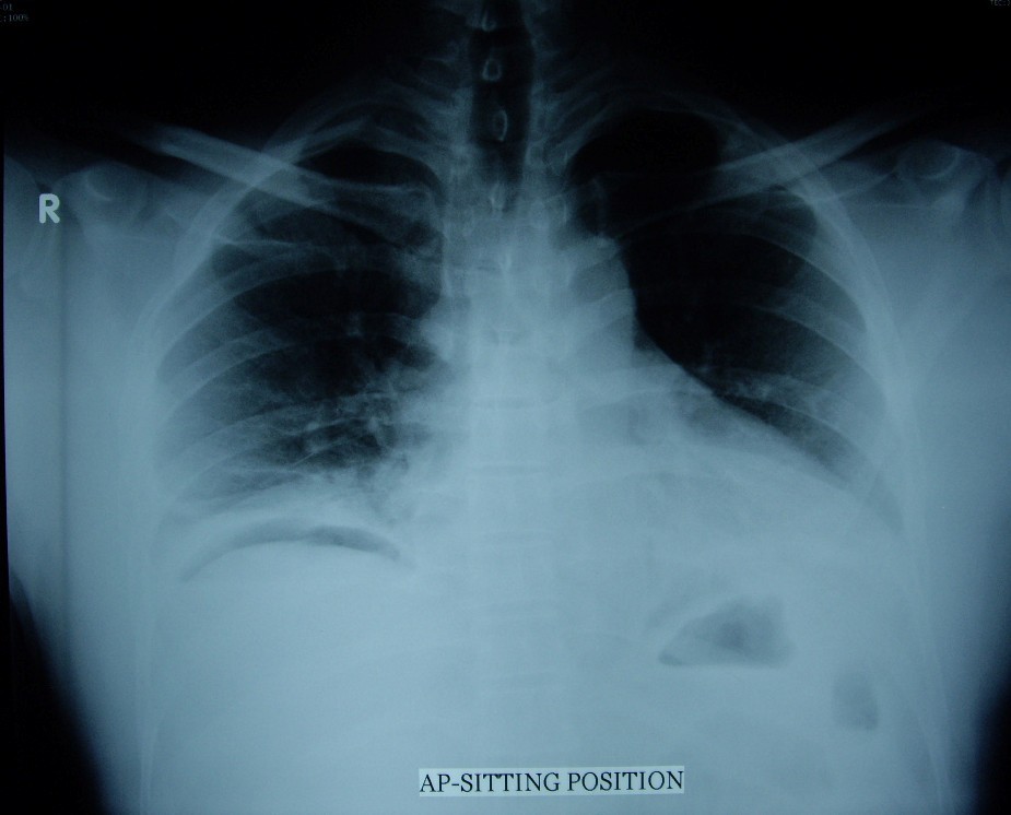 liver cut Self anus infected Clit hood split story