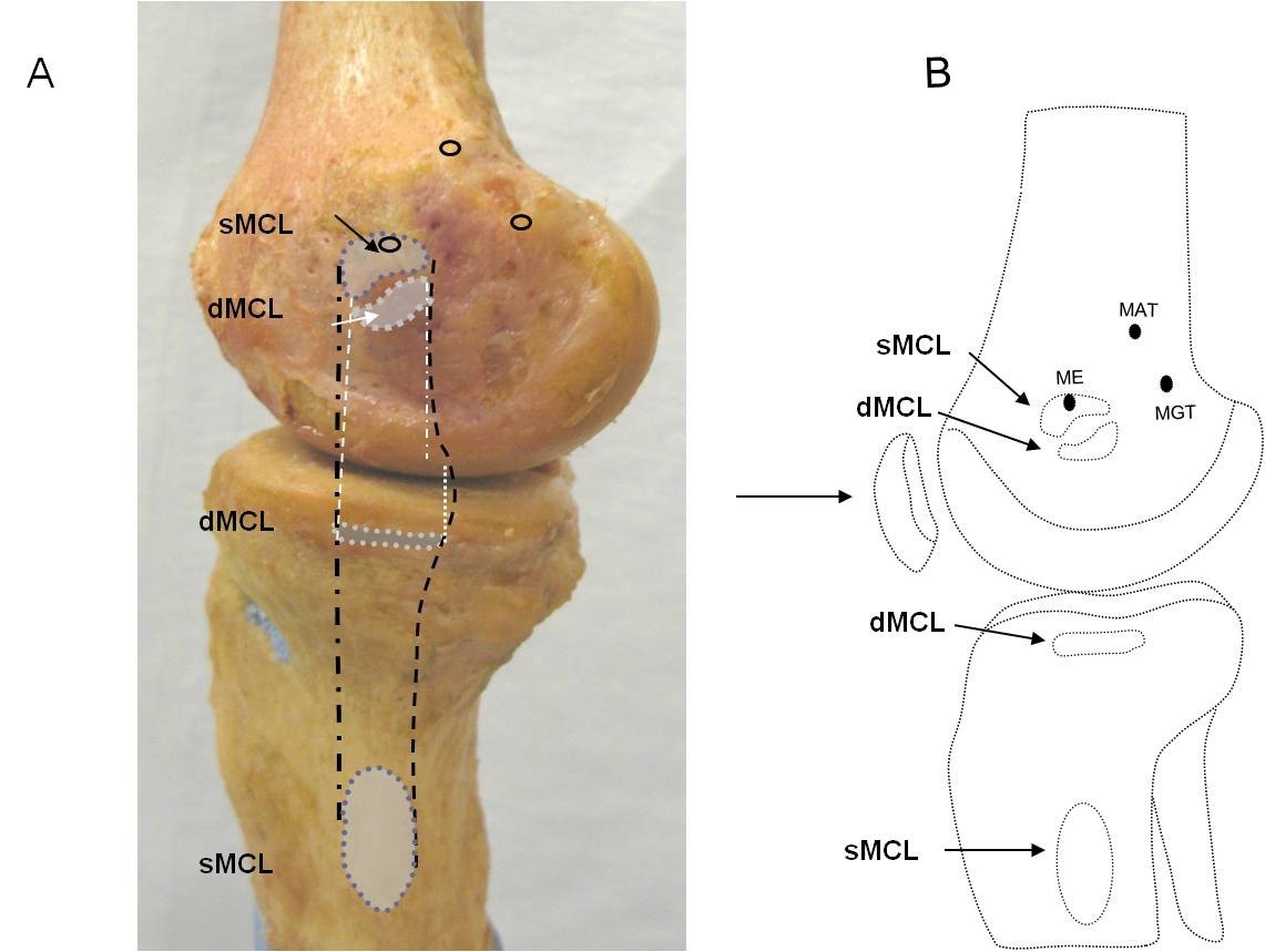Morphology of the medial collateral ligament of the knee | Journal of