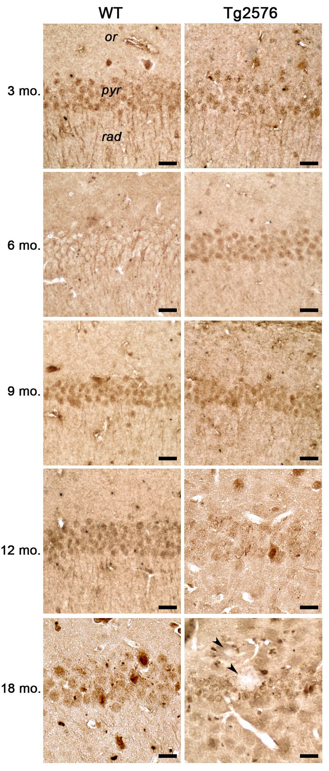 Age-dependent roles of peroxisomes in the hippocampus of a transgenic
