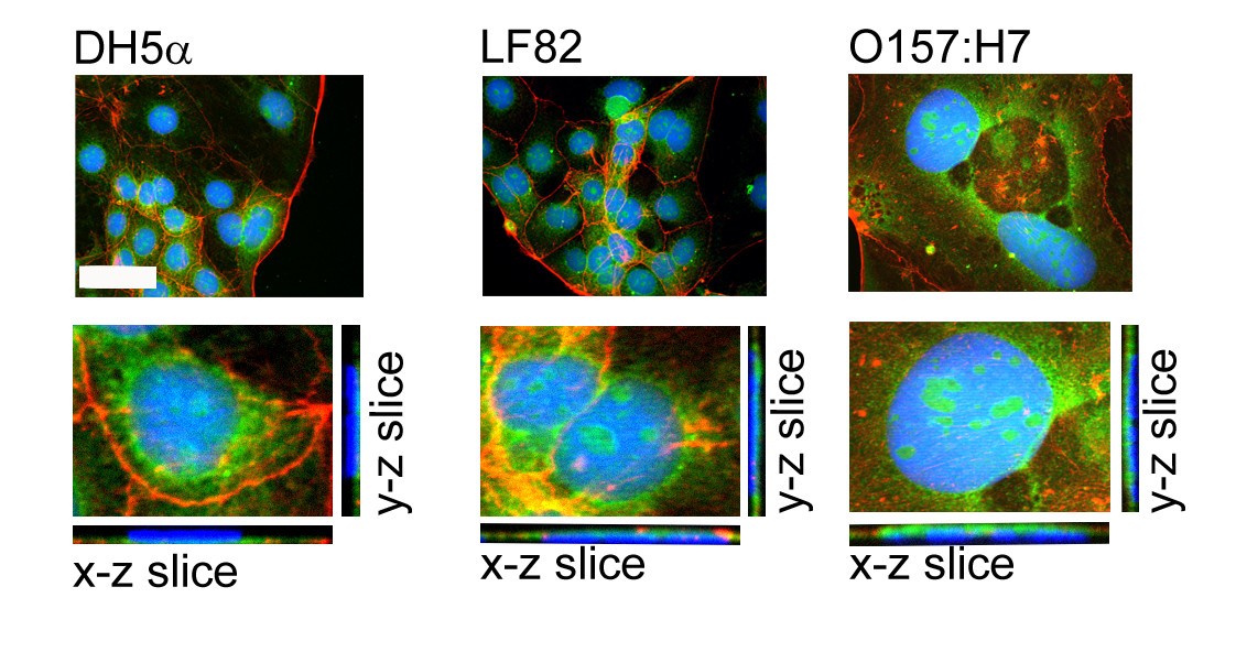 Escherichia coli-derived outer membrane vesicles are genotoxic to human