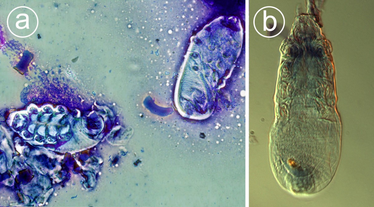 Demodex gatoi associated contagious pruritic dermatosis in cats a