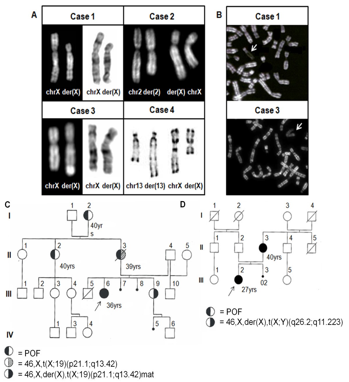 Investigating the role of X chromosome breakpoints in premature ovarian