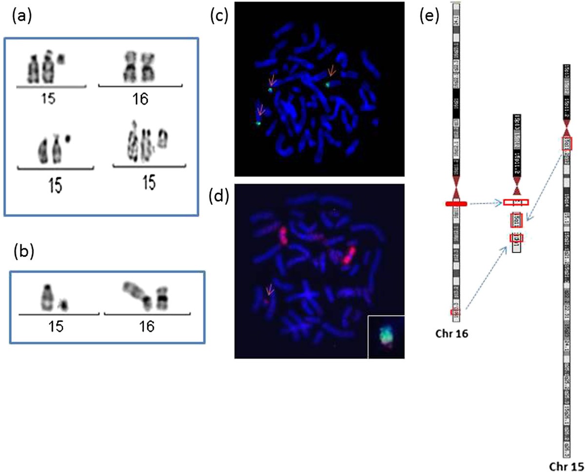 Complex Small Supernumerary Marker Chromosome With A 15q/16p ...