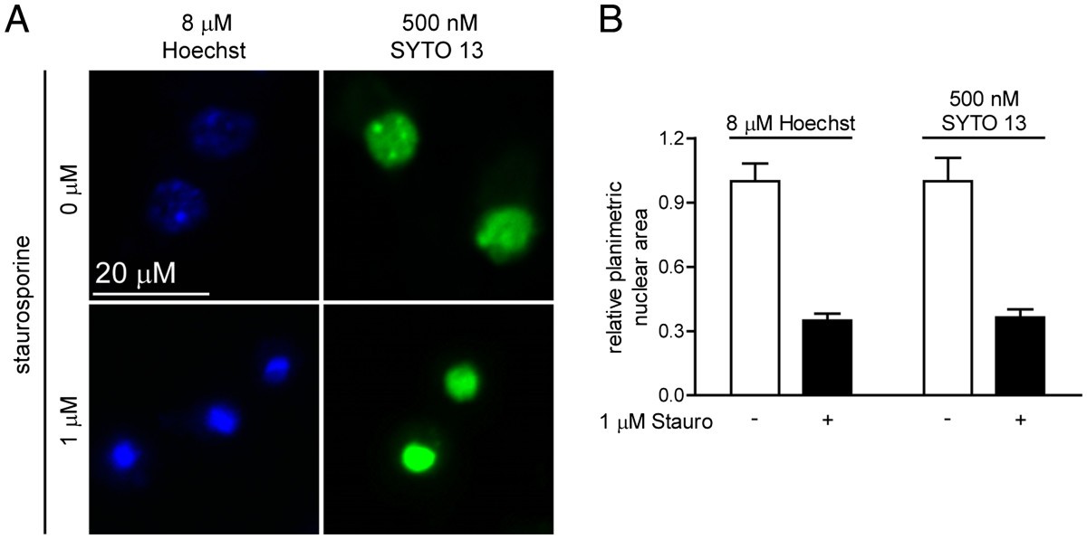Compatibility of SYTO 13 and Hoechst 33342 for longitudinal imaging of