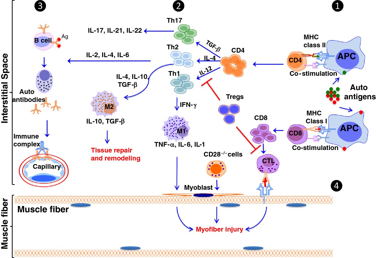 Idiopathic inflammatory myopathies pathogenic mechanisms of muscle
