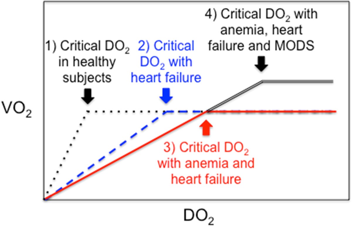 Anemia and red blood cell transfusion in critically ill 