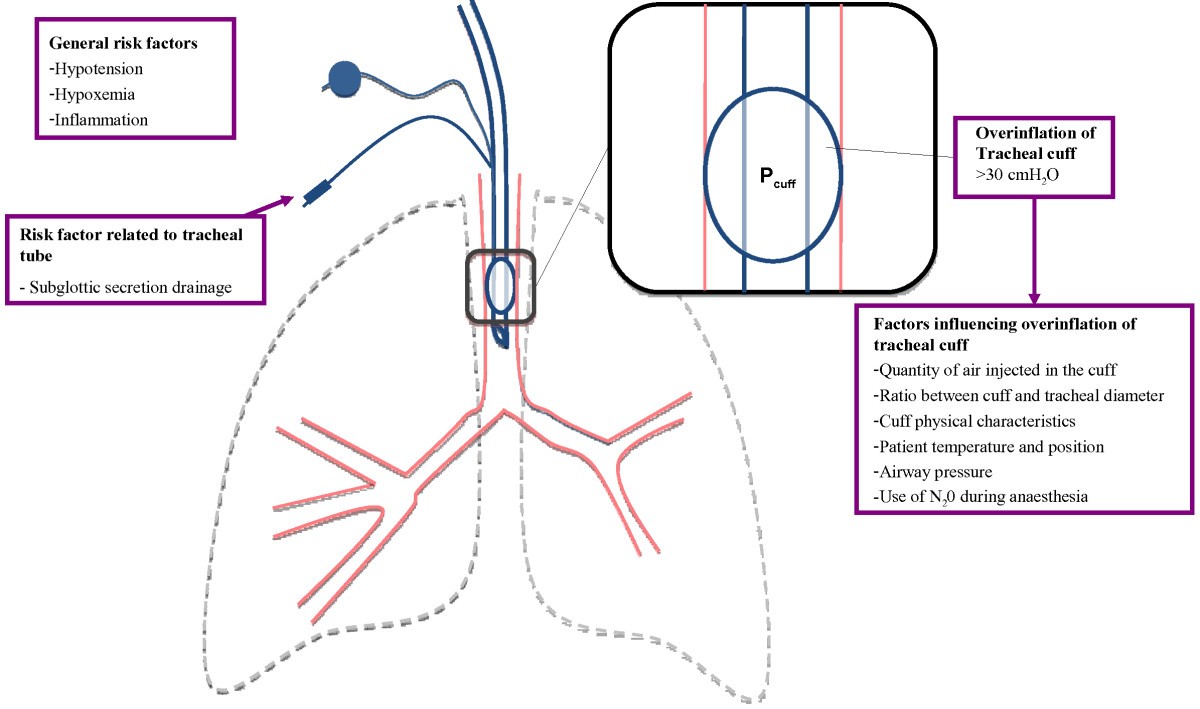 Optimal care and design of the tracheal cuff in the critically ill