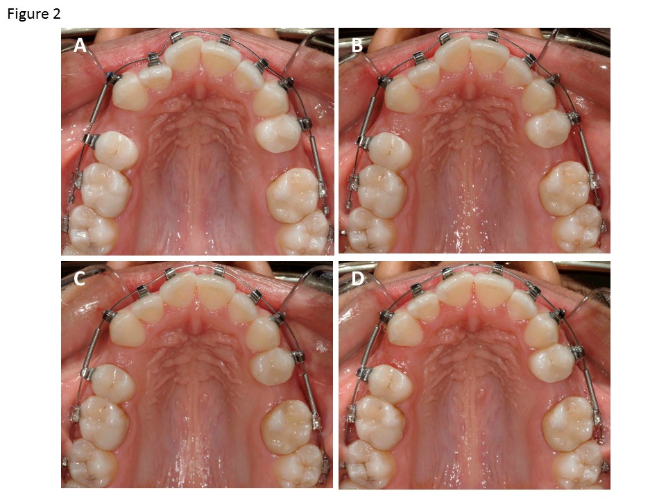 orthodontic orthodontics