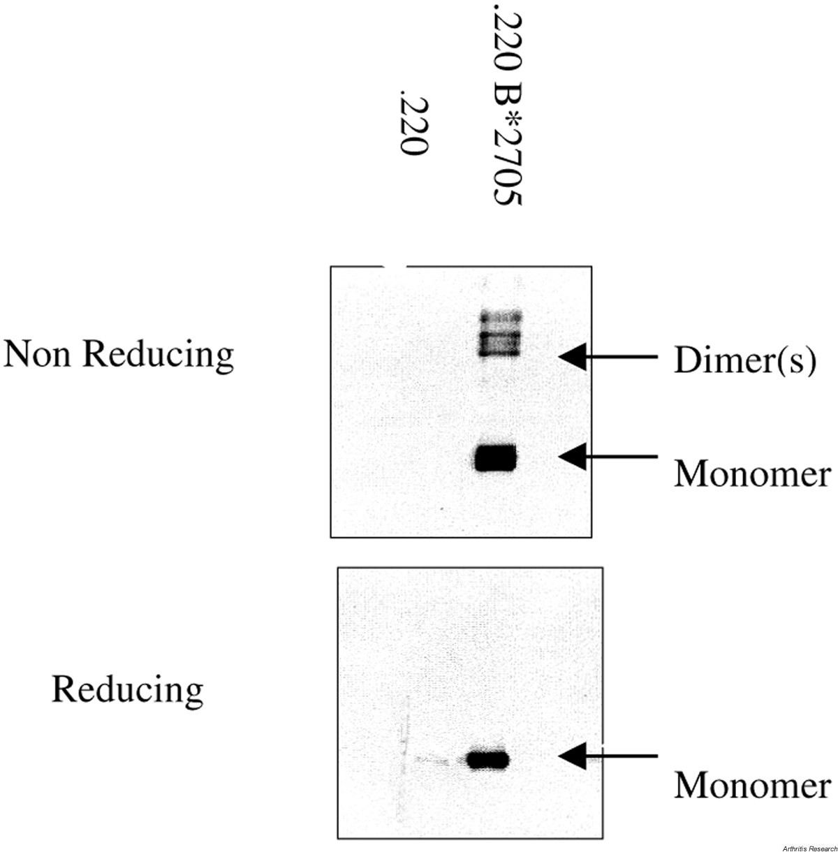 HLA-B27: natural function and pathogenic role in spondyloarthritis ...