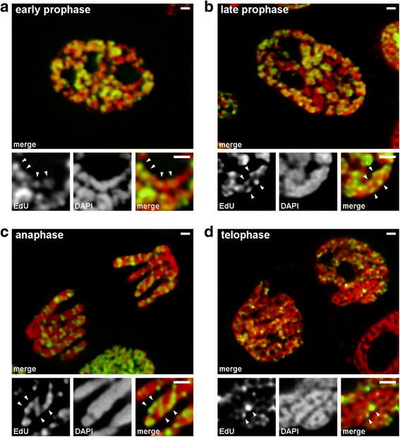 Visualization of chromosome condensation in plants with large ... Biology Diagrams