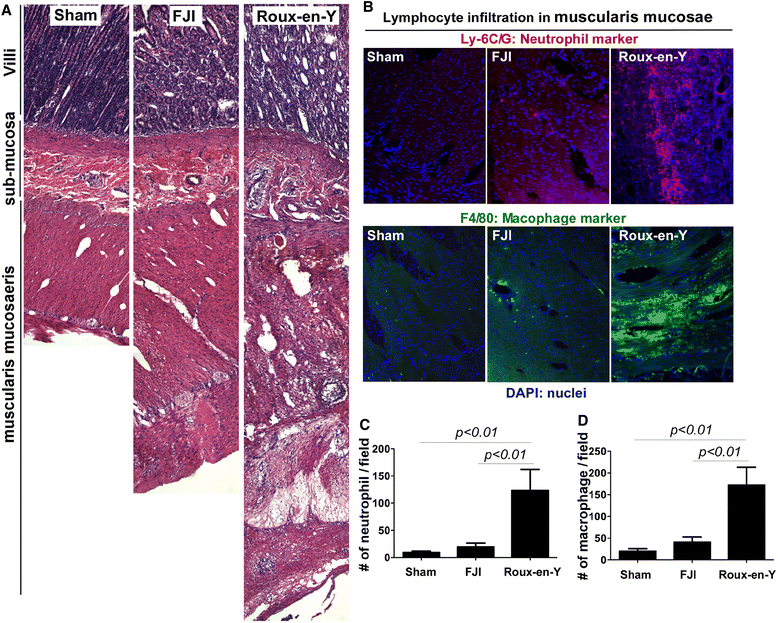 Functional jejunal interposition, a reconstruction procedure, promotes