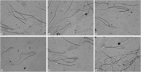 and defects abnormalities Sperm birth