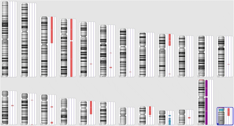 Coexistence of iAMP21 and ETV6-RUNX1 fusion in an adolescent with B ...