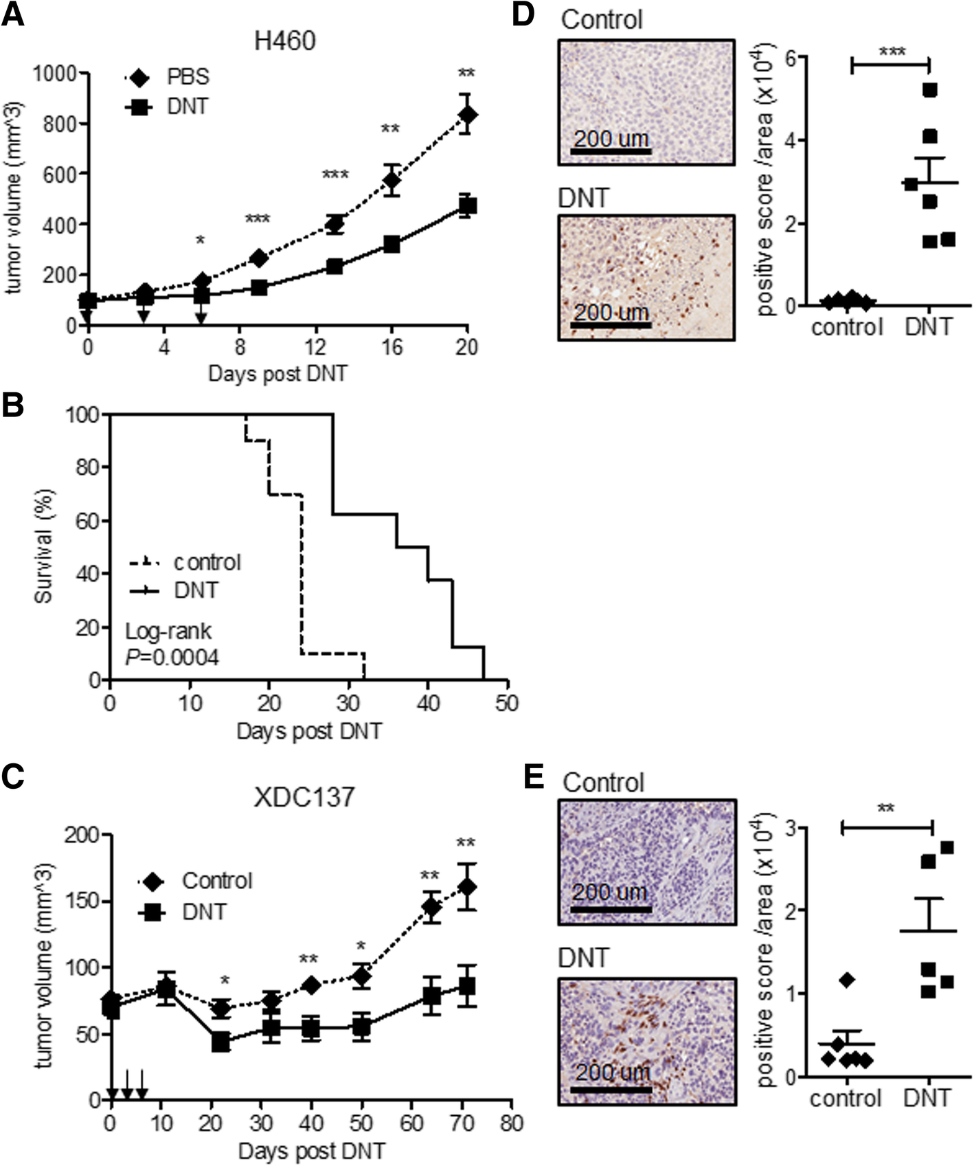 Targeting late-stage non-small cell lung cancer with a combination of