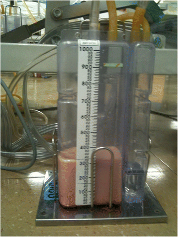 Delayed right chylothorax after left blunt chest trauma: a case report