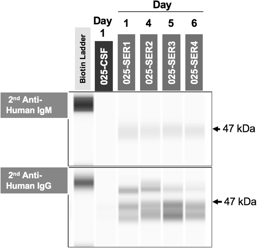 Aseptic meningitis caused by torque teno virus in an infant a case