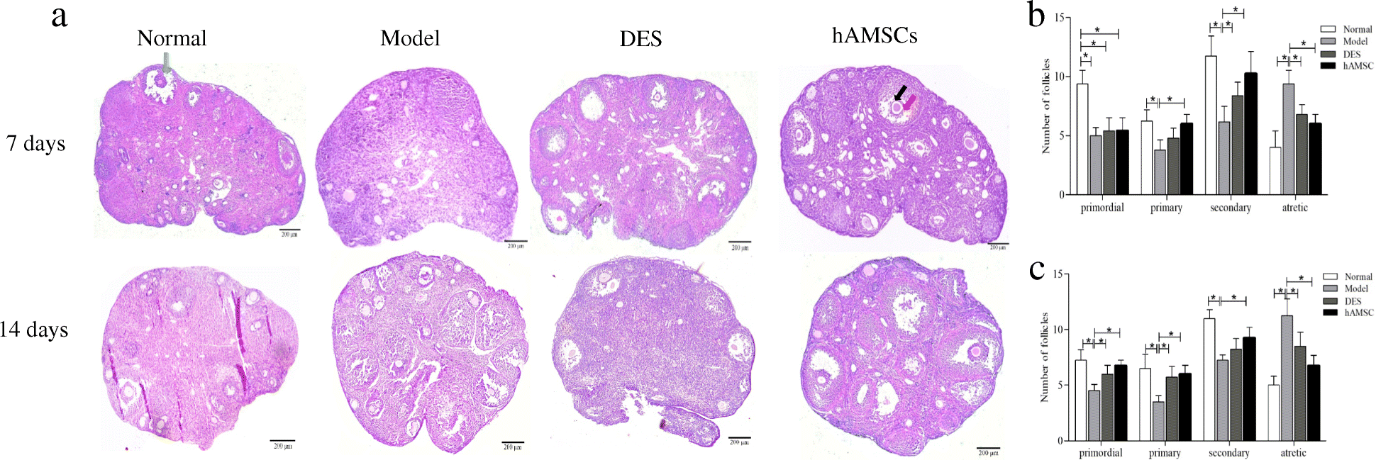 ovarian mesenchymal microenvironment premature amniotic follicular transplantation pof