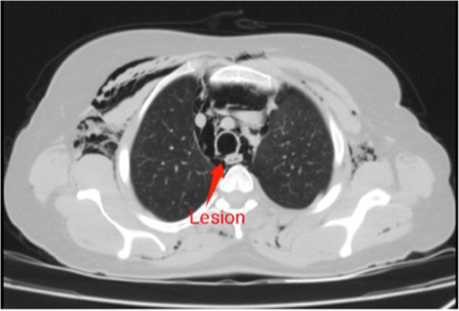 Anesthetic consideration for airway management of patients undergoing