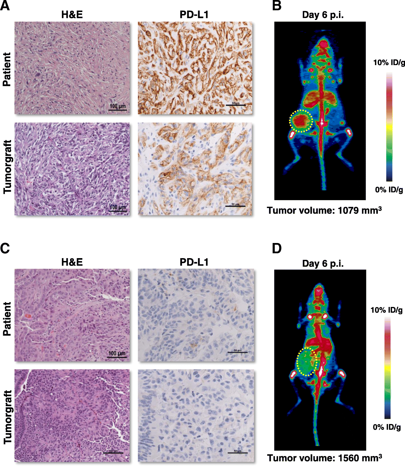 PDL1 detection using 89 Zratezolizumab immunoPET in