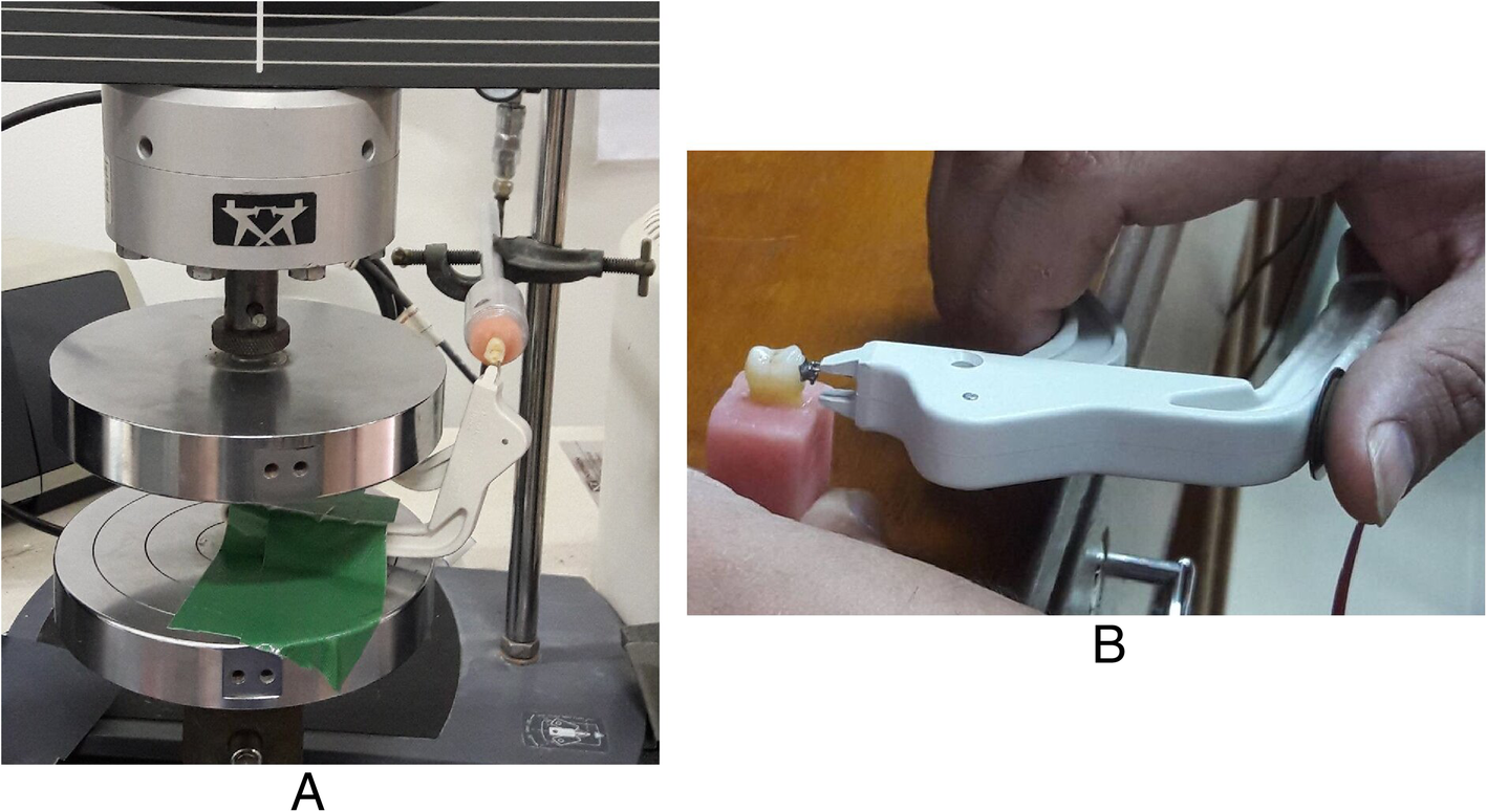 Validation and reliability of a prototype orthodontic bracket debonding