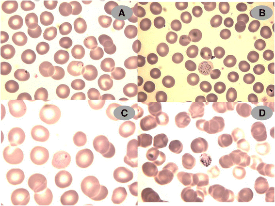 First imported Plasmodium ovale malaria in Central America: case report ...