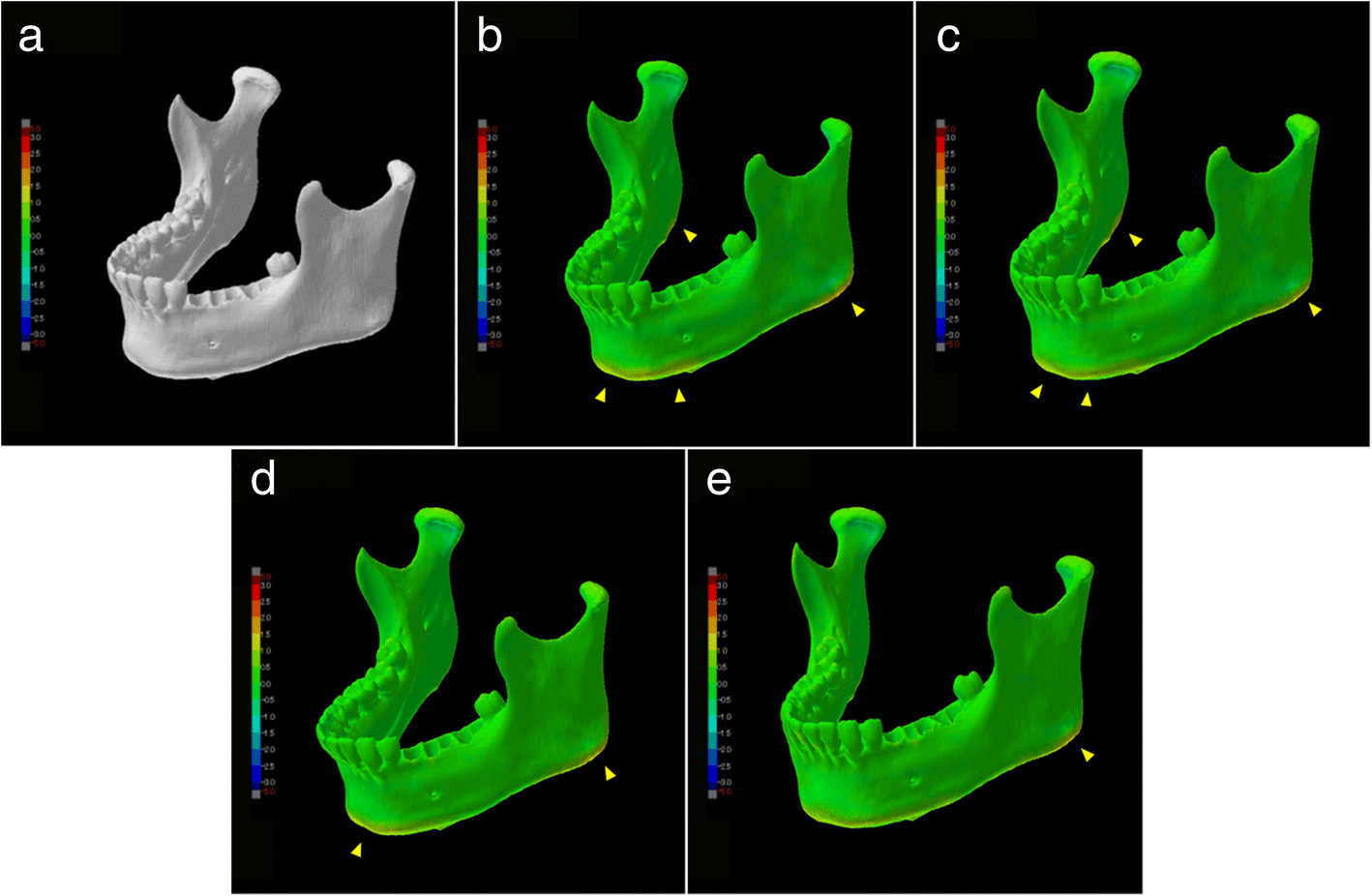 Utilizing a low-cost desktop 3D printer to develop a "one-stop 3D ... - 41205 2018 28 Fig3 HTML