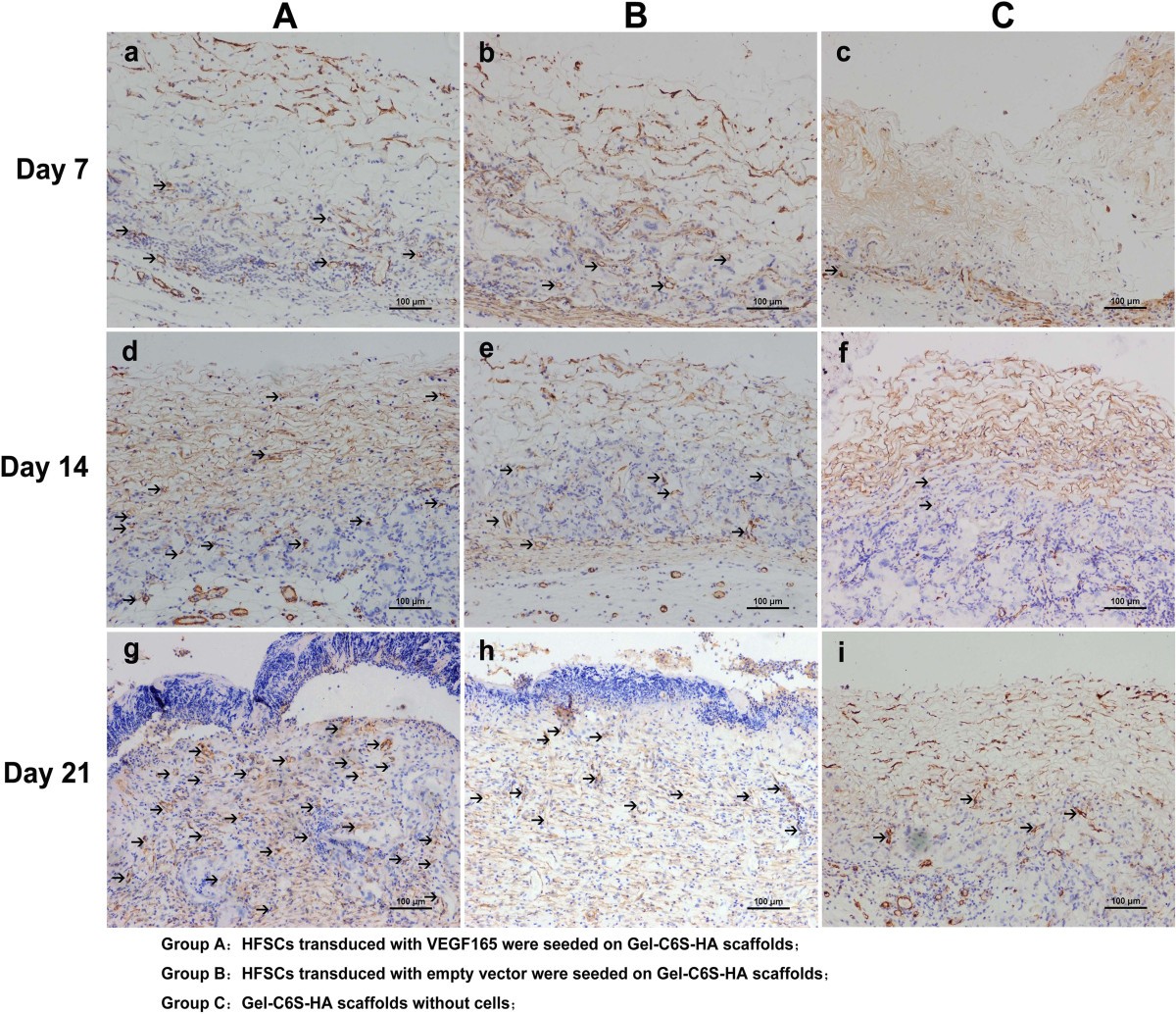 Gelatinchondroitin6sulfatehyaluronic acid scaffold seeded with