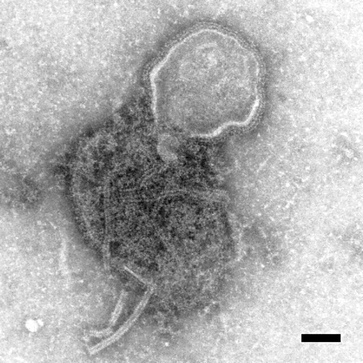 Hendra virus. Fig. 1
