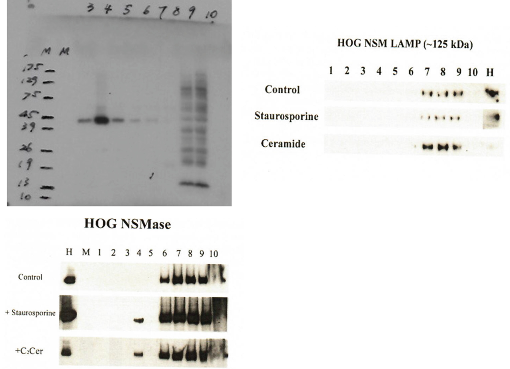 Figure 3 | Isolation of Lipid Rafts (Detergent-Resistant Microdomains) and  Comparison to Extracellular Vesicles (Exosomes) | SpringerLink