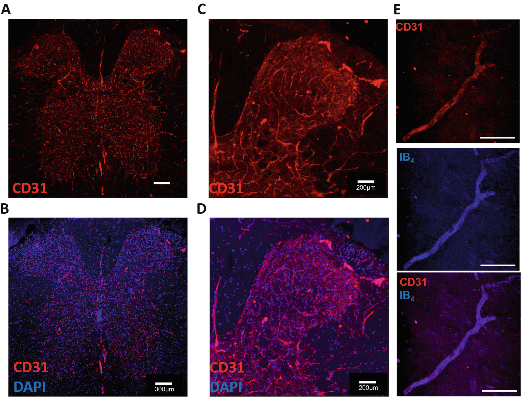 Figure 1 Quantifying Vascular Remodeling In The Mouse Spinal Cord Springerlink