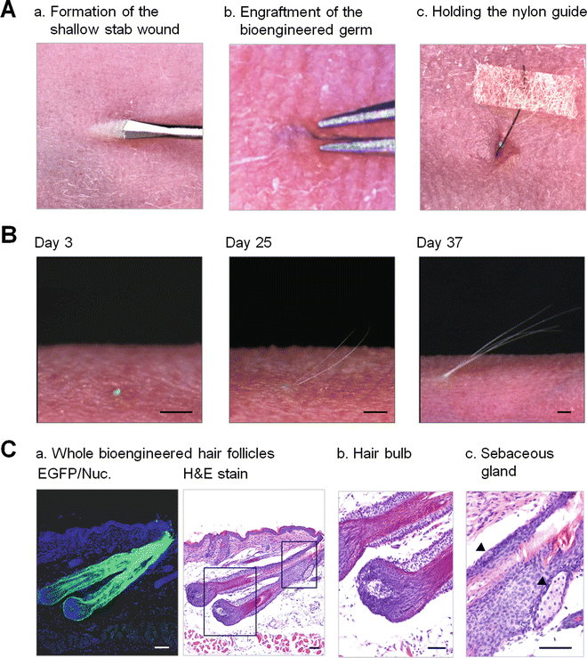 Figure 4 | Hair Follicle Regeneration by Transplantation of a Bioengineered Hair Follicle Germ | SpringerLink Figure 4 | Hair Follicle Regeneration by Transplantation of a Bioengineered Hair Follicle Germ | SpringerLink