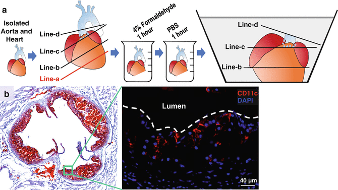 Figure 5 Isolation And Characterization Of Aortic Dendritic Cells And Lymphocytes In Atherosclerosis Springerlink