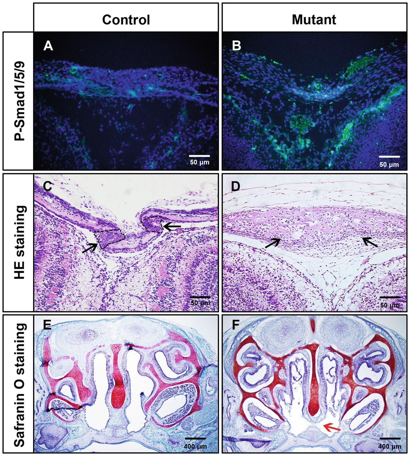 Figure 1 | Phenotypic Analyses of Genetically Modified Mice for BMP  Receptors | SpringerLink