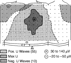 Figure 32.11