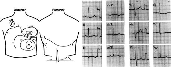 Figure 32.13