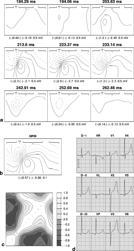 Figure 32.5