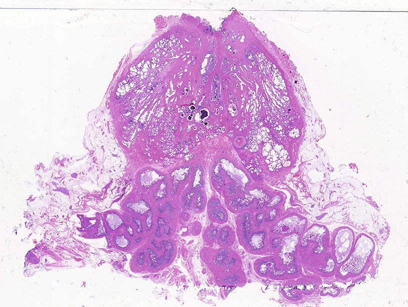 Seminal Vesicle, Normal Histology, Fig. 1