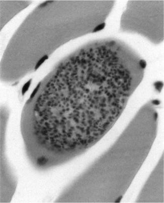 Sarcocystis lindemanni, Fig. 1