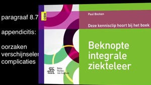 8.7 Appendicitis oorzaken, verschijnselen, complicaties_Picture