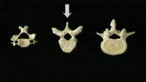 3.1 Het skelet en de gewrichten en ligamenten van de wervelkolom_Picture