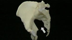5.2 Het skelet en de ligamenten van het bekken_Picture