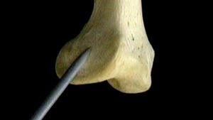 5.8 Het skelet en de ligamenten van de knie_Picture