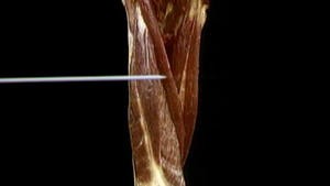 5.9 De spieren rond de knie_Picture