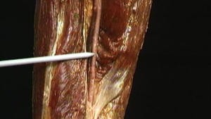 5.10 De vaten en de zenuwen van de knie_Picture