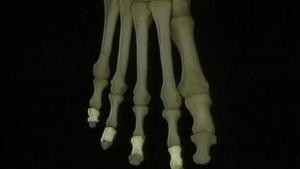 5.14 Het skelet en de gewrichten en ligamenten van de voet_Picture